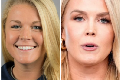 Plastic Surgeons Weigh in on Viral Photos of Karoline Leavitt Amid Online Speculation